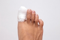 What to Do if You Break a Toe
